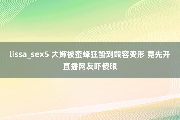 lissa_sex5 大婶被蜜蜂狂蛰到毁容变形 竟先开直播网友吓傻眼